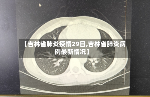 【吉林省肺炎疫情29日,吉林省肺炎病例最新情况】