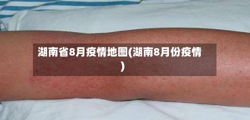 湖南省8月疫情地图(湖南8月份疫情)